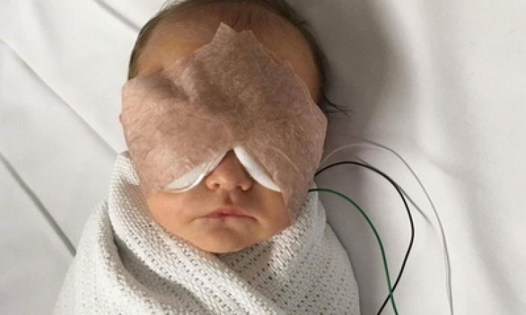 Baby wearing eye patches