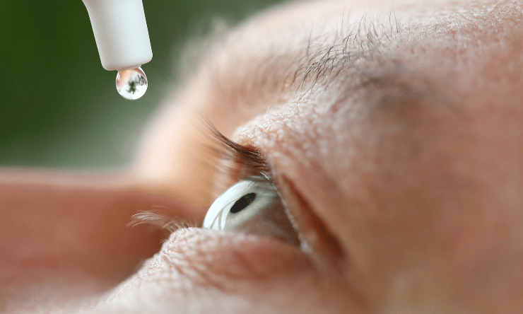 A close up of an eye drop about to be instilled into a man's eye.