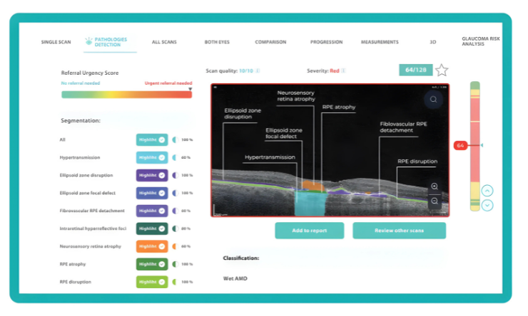 Altris biomarkers