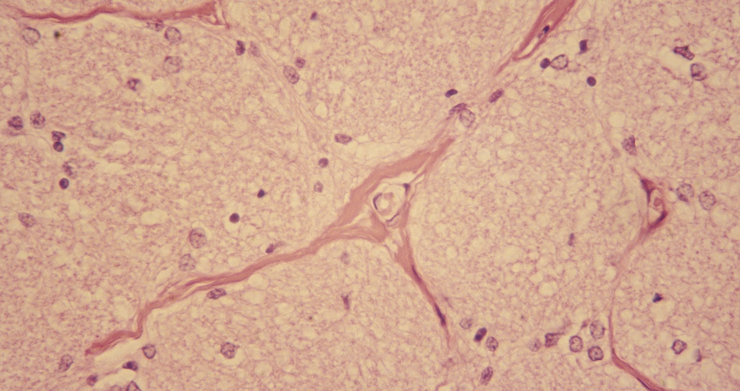 Microscopic image of moisture cells