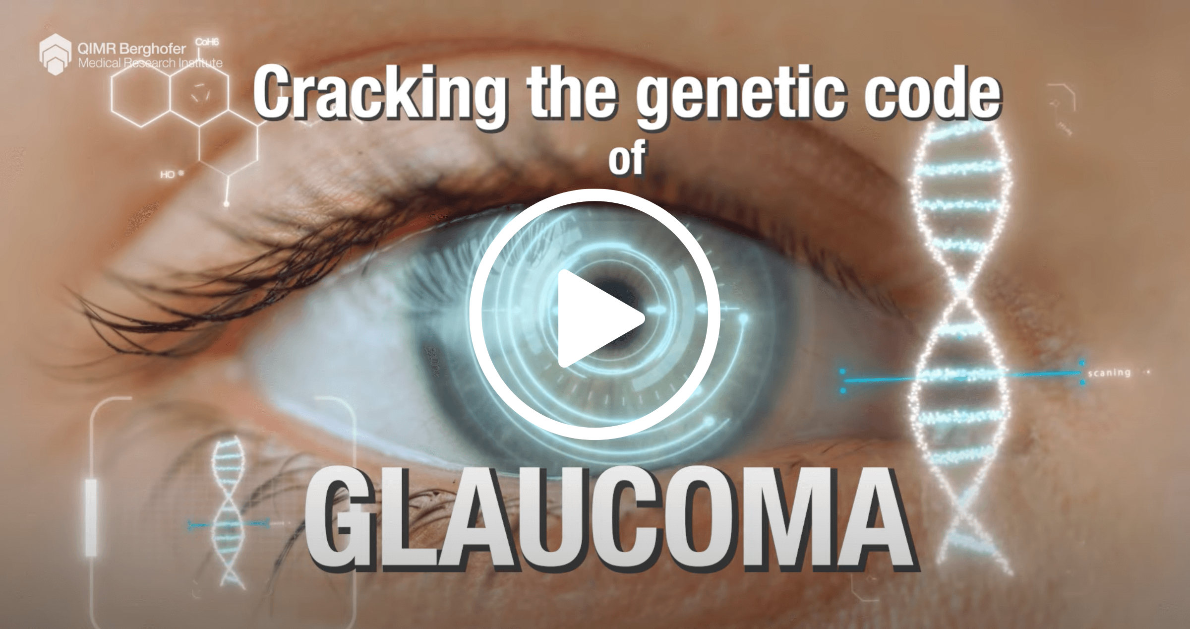 Video: Genetic Discovery Could Help Prevent Irreversible Blindness In People With Glaucoma