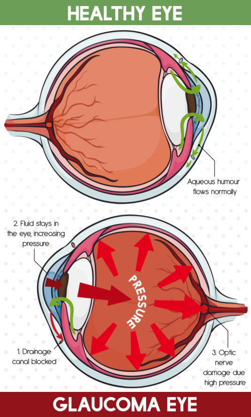 Eye diagram