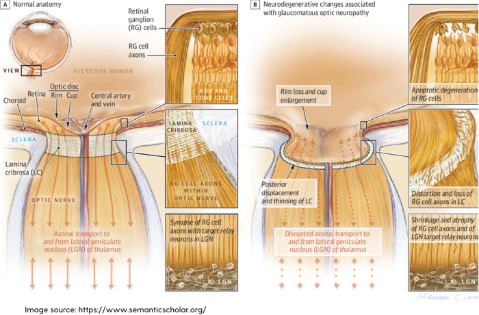 Eye diagram