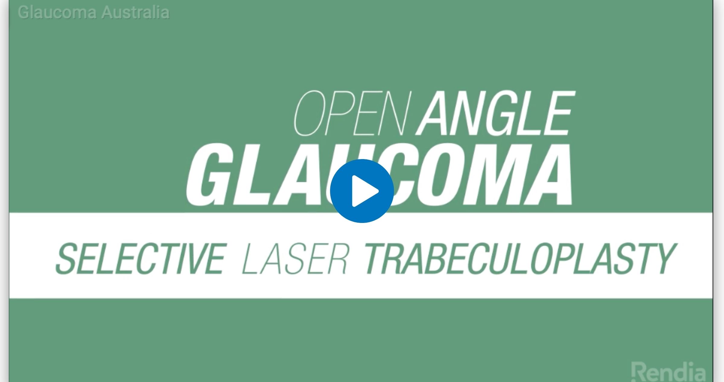 Selective Laser Trabeculoplasty (SLT)