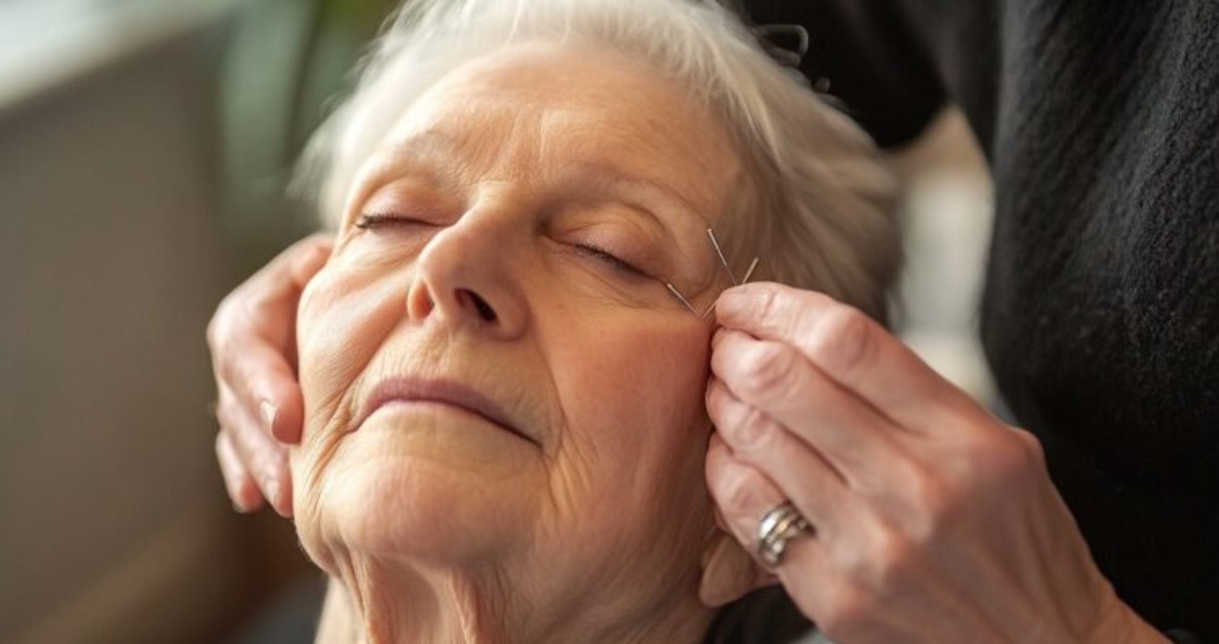 Study finds acupuncture shows promise as therapy for glaucoma