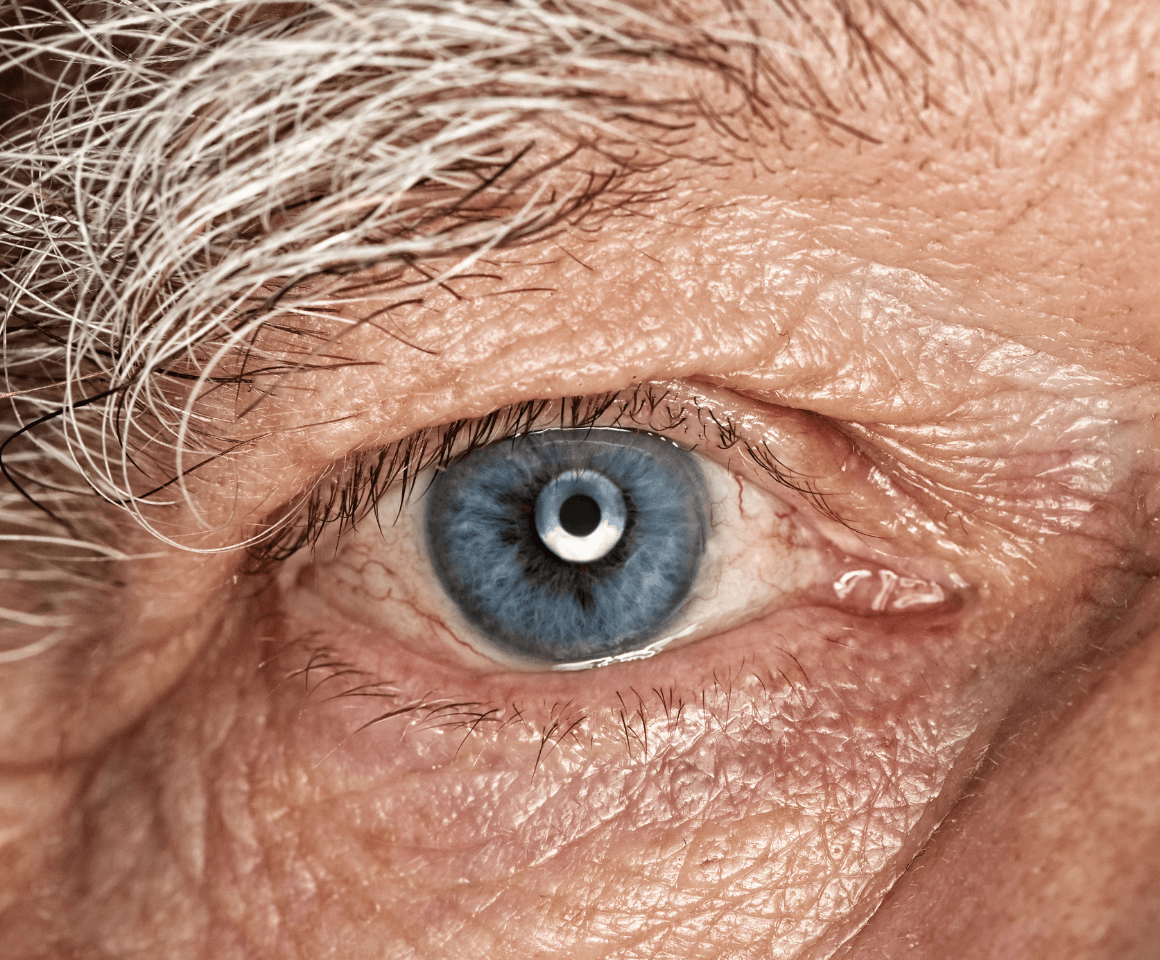 A close-up of an older man's eye